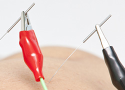 electropunctuur
